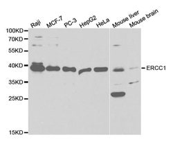 Invitrogen ERCC1 Polyclonal Antibody 100 &mu;L; Unconjugated:Antibodies,