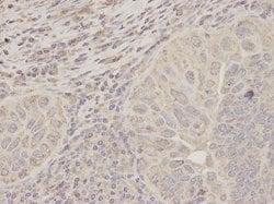 Invitrogen ACAT1 Polyclonal Antibody 100 &mu;L; Unconjugated:Antibodies,
