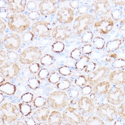 Invitrogen ACAT1 Polyclonal Antibody 100 &mu;L; Unconjugated:Antibodies,