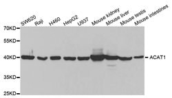 Invitrogen ACAT1 Polyclonal Antibody 100 &mu;L; Unconjugated:Antibodies,