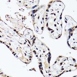 Invitrogen BAF53A Polyclonal Antibody 100 &mu;L; Unconjugated:Antibodies,