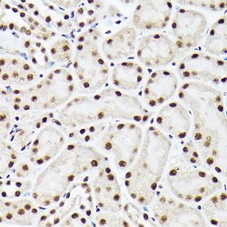 Invitrogen BAF53A Polyclonal Antibody 100 &mu;L; Unconjugated:Antibodies,
