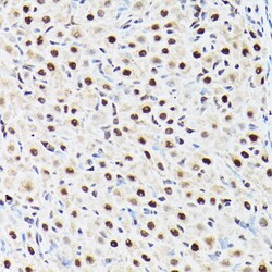 Invitrogen BAF53A Polyclonal Antibody 100 &mu;L; Unconjugated:Antibodies,