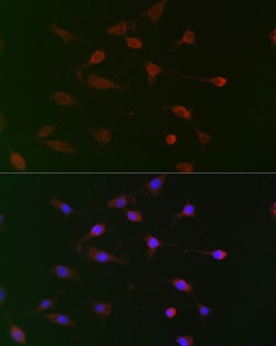 Invitrogen Cdc34 Polyclonal Antibody 100 &mu;L; Unconjugated:Antibodies,
