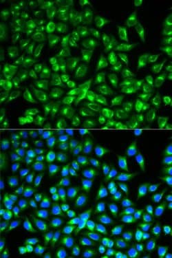 Invitrogen Cdc34 Polyclonal Antibody 100 &mu;L; Unconjugated:Antibodies,