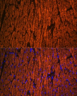 Invitrogen MYL2 Polyclonal Antibody 100 &mu;L; Unconjugated:Antibodies,