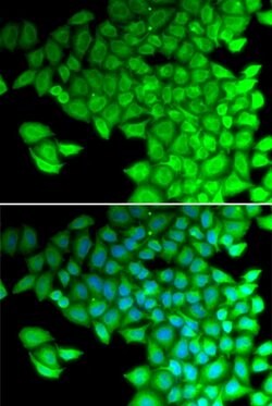 Invitrogen MYL2 Polyclonal Antibody 100 &mu;L; Unconjugated:Antibodies,