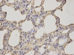 Invitrogen ALDH3A1 Polyclonal Antibody 100 &mu;L | Buy Online | Invitrogen&trade; | Fisher Scientific