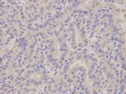 Invitrogen ALDH3A1 Polyclonal Antibody 100 &mu;L | Buy Online | Invitrogen&trade; | Fisher Scientific