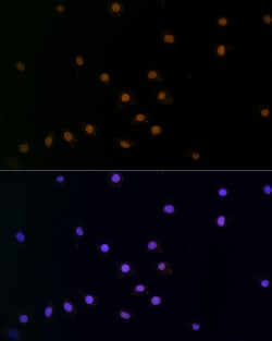 Invitrogen SNAIL Polyclonal Antibody 100 &mu;L | Buy Online | Invitrogen&trade; | Fisher Scientific