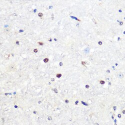 Invitrogen SNAIL Polyclonal Antibody 100 &mu;L | Buy Online | Invitrogen&trade; | Fisher Scientific