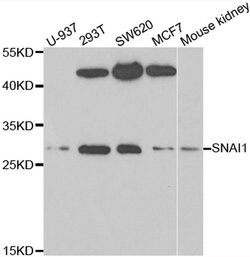 Invitrogen SNAIL Polyclonal Antibody 100 &mu;L | Buy Online | Invitrogen&trade; | Fisher Scientific