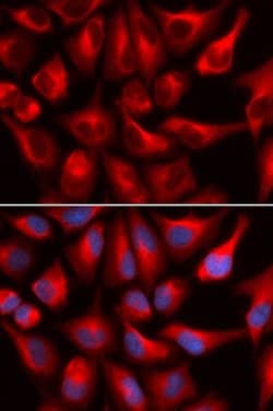 Invitrogen DDX3 Polyclonal Antibody 100 &mu;L; Unconjugated:Antibodies,