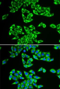 Invitrogen DDX3 Polyclonal Antibody 100 &mu;L; Unconjugated:Antibodies,