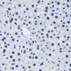 Invitrogen Livin Polyclonal Antibody 100 &mu;L; Unconjugated:Antibodies,
