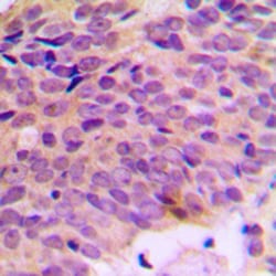 Invitrogen ATP5A1 Polyclonal Antibody 100 &mu;L; Unconjugated:Antibodies,