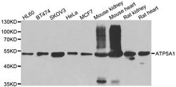 Invitrogen ATP5A1 Polyclonal Antibody 100 &mu;L; Unconjugated:Antibodies,