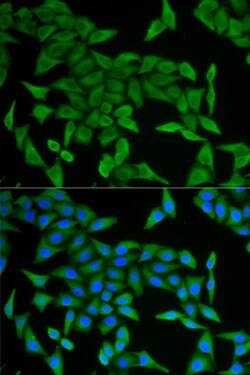 CRABP2 Polyclonal Antibody 100 &mu;L | Buy Online | Thermo Scientific | Fisher Scientific