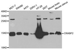 CRABP2 Polyclonal Antibody 100 &mu;L | Buy Online | Thermo Scientific | Fisher Scientific