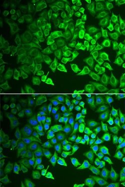 Invitrogen GIF Polyclonal Antibody 100 &mu;L; Unconjugated:Antibodies,