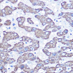 Invitrogen GOT2 Polyclonal Antibody 100 &mu;L; Unconjugated:Antibodies,