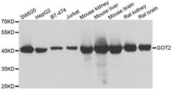 Invitrogen GOT2 Polyclonal Antibody 100 &mu;L; Unconjugated:Antibodies,
