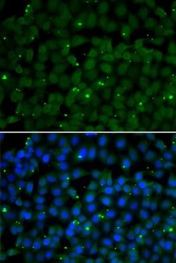 Invitrogen GPI Polyclonal Antibody 100 &mu;L; Unconjugated:Antibodies,