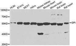 Invitrogen GPI Polyclonal Antibody 100 &mu;L; Unconjugated:Antibodies,
