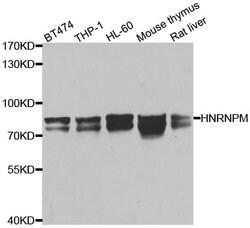 Invitrogen&trade;&nbsp;hnRNP M Polyclonal Antibody