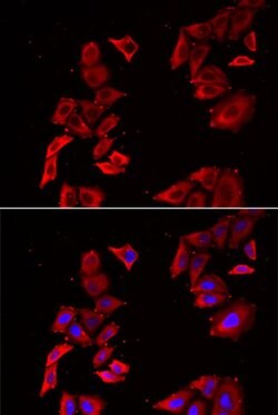 Invitrogen MEK5 Polyclonal Antibody 100 &mu;L; Unconjugated:Antibodies,