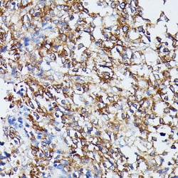 Invitrogen MEK5 Polyclonal Antibody 100 &mu;L; Unconjugated:Antibodies,