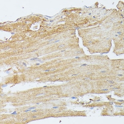 Invitrogen MEK5 Polyclonal Antibody 100 &mu;L; Unconjugated:Antibodies,