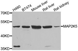 Invitrogen MEK5 Polyclonal Antibody 100 &mu;L; Unconjugated:Antibodies,