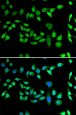 Invitrogen DNAJB6 Polyclonal Antibody 100 &mu;L; Unconjugated:Antibodies,