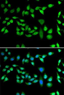 Invitrogen DNAJB6 Polyclonal Antibody 100 &mu;L; Unconjugated:Antibodies,