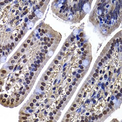 Invitrogen DNAJB6 Polyclonal Antibody 100 &mu;L; Unconjugated:Antibodies,