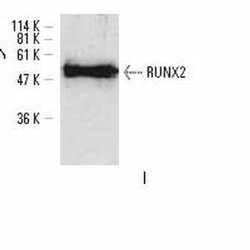 Invitrogen RUNX2 Polyclonal Antibody 100 &mu;L; Unconjugated:Antibodies,