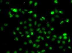 Invitrogen BCL6 Polyclonal Antibody 100 &mu;L; Unconjugated:Antibodies,