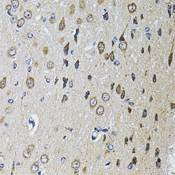 Invitrogen PTPRE Polyclonal Antibody 100 &mu;L; Unconjugated:Antibodies,