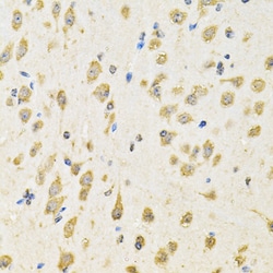 Invitrogen PTPRE Polyclonal Antibody 100 &mu;L; Unconjugated:Antibodies,