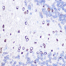 GOLPH2 Polyclonal Antibody:Antibodies, Polyclonal