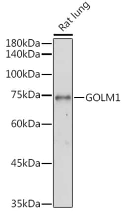 GOLPH2 Polyclonal Antibody:Antibodies, Polyclonal