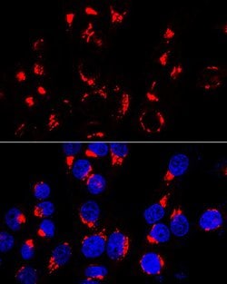 GOLPH2 Polyclonal Antibody:Antibodies, Polyclonal