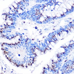 GOLPH2 Polyclonal Antibody:Antibodies, Polyclonal