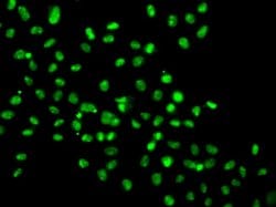 Invitrogen HMG20A Polyclonal Antibody 100 &mu;L; Unconjugated:Antibodies,