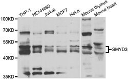 Invitrogen SMYD3 Polyclonal Antibody 100 &mu;L; Unconjugated:Anticuerpos