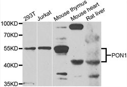 Invitrogen PON1 Polyclonal Antibody 100 &mu;L; Unconjugated:Antistoffer