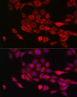 Invitrogen Annexin A11 Polyclonal Antibody 100 &mu;L; Unconjugated:Antibodies,