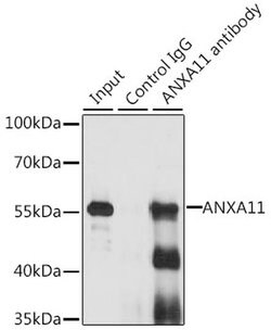 Invitrogen Annexin A11 Polyclonal Antibody 100 &mu;L; Unconjugated:Antibodies,