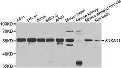 Invitrogen Annexin A11 Polyclonal Antibody 100 &mu;L; Unconjugated:Antibodies,